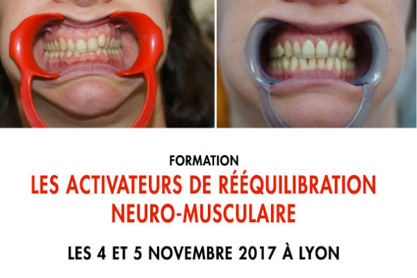Formation « Les activateurs de rééquilibration neuro-musculaire » - ODENTH